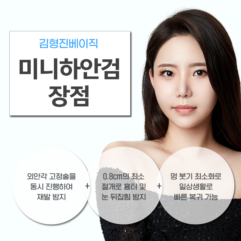 미니하안검절개 부담 갖지 마세요! 관련 이미지 5