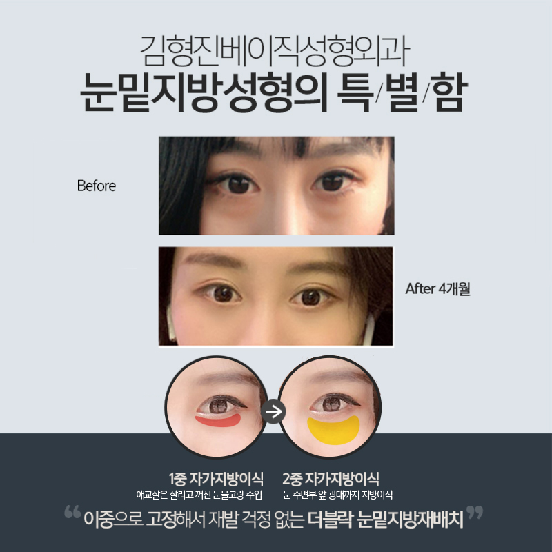 강남눈밑지 이제는 남자도 관리해야 되는 시대에요 관련 이미지 5