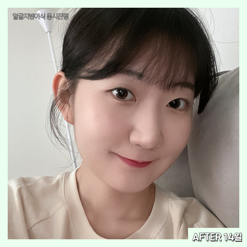 얼굴살빼는법 이렇게 간단한 방법이? 관련 이미지 5