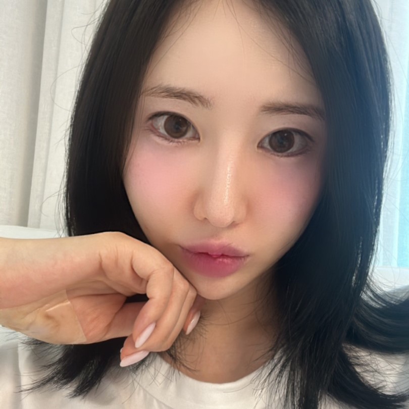 눈밑지수술 효과 대박이에요ㅠㅠ 관련 이미지 3