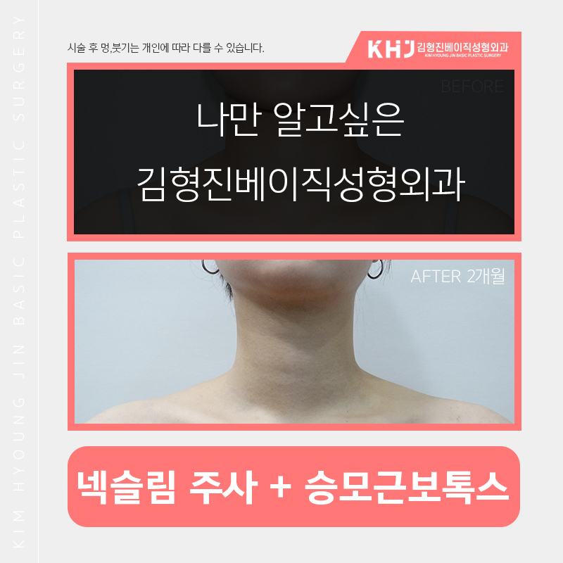 예비신부관리 시작해보자구요! 관련 이미지 3
