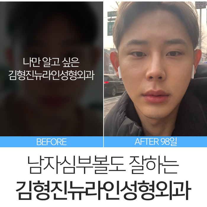 남자심부볼 깔끔하게 정리해요 관련 이미지 7
