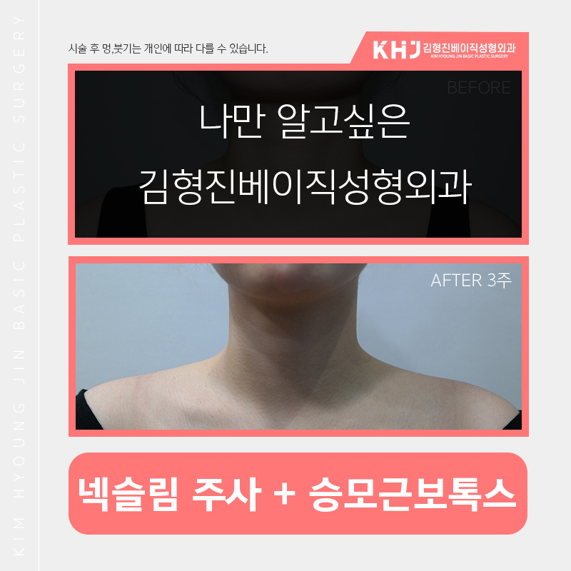예비신부관리 시작해보자구요! 관련 이미지 7