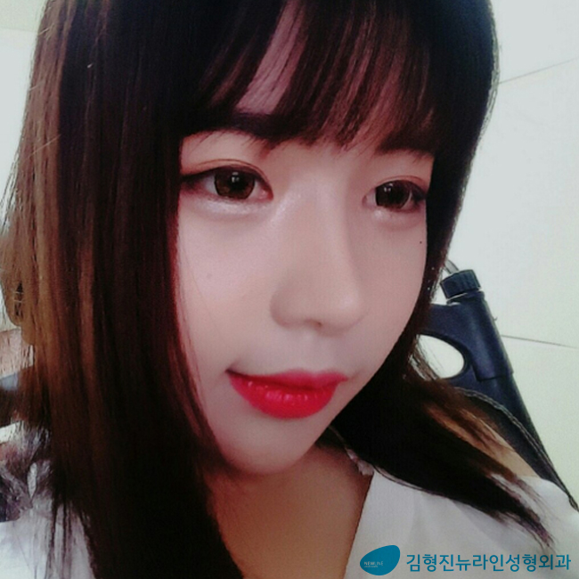 부산아큐리프트, 진짜는 모두가 알아보는법! 관련 이미지 2