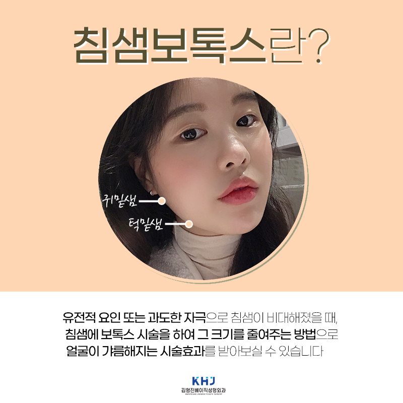 자연스러움이 다른 침샘보톡스후기 후회 없어요 관련 이미지 4