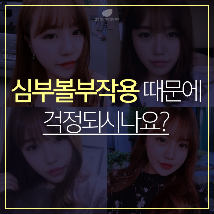 하악심부볼지방제거 수술로 부작용없는 김형진뉴라인성형외과 관련 이미지 2
