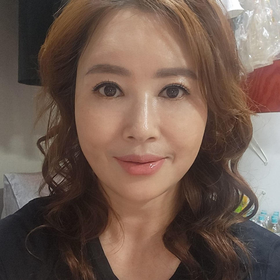 중년눈수술후기 진짜 어쩌면 좋죠? 관련 이미지 2