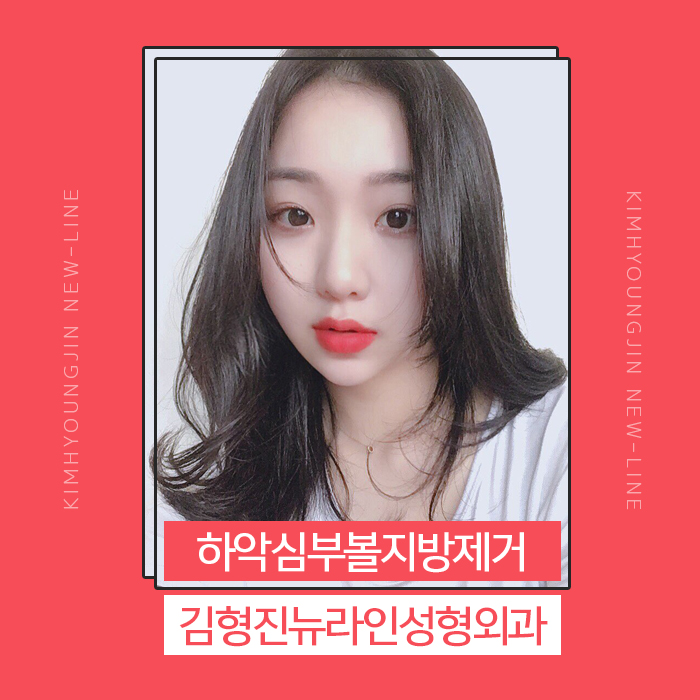 심부볼가격 아직도 싼 곳만 찾아요? 관련 이미지 1