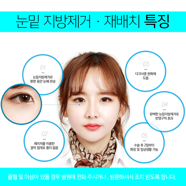 눈밑지방제거가격보다 중요한건 ? 관련 이미지 2
