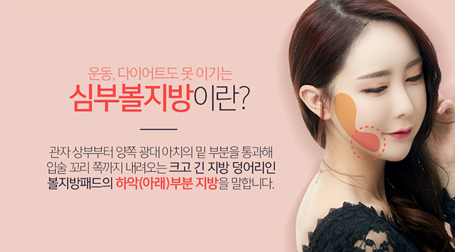 부산심부볼 여기서 빼자~! 관련 이미지 2