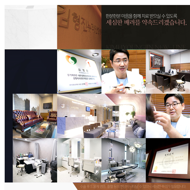 처진살리프팅으로 UP! UP!! 관련 이미지 4