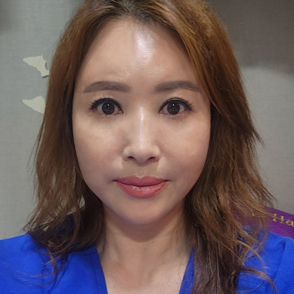 중년눈밑처짐 해결방법 찾고 계셨다면 관련 이미지 2