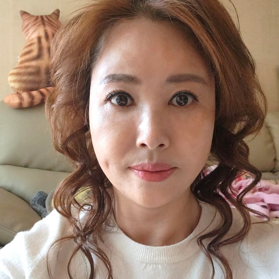 중년하안검으로 나이 들어 보이는 원인 해결했어요 관련 이미지 2