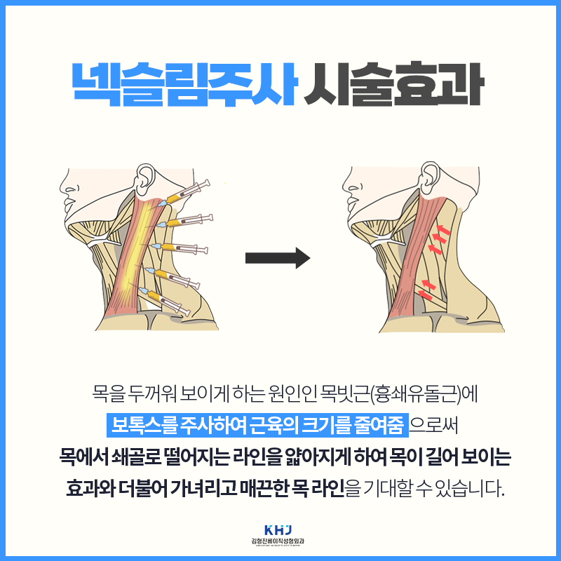 슬림한 넥라인 만들어주는 목얇아지는방법 관련 이미지 4
