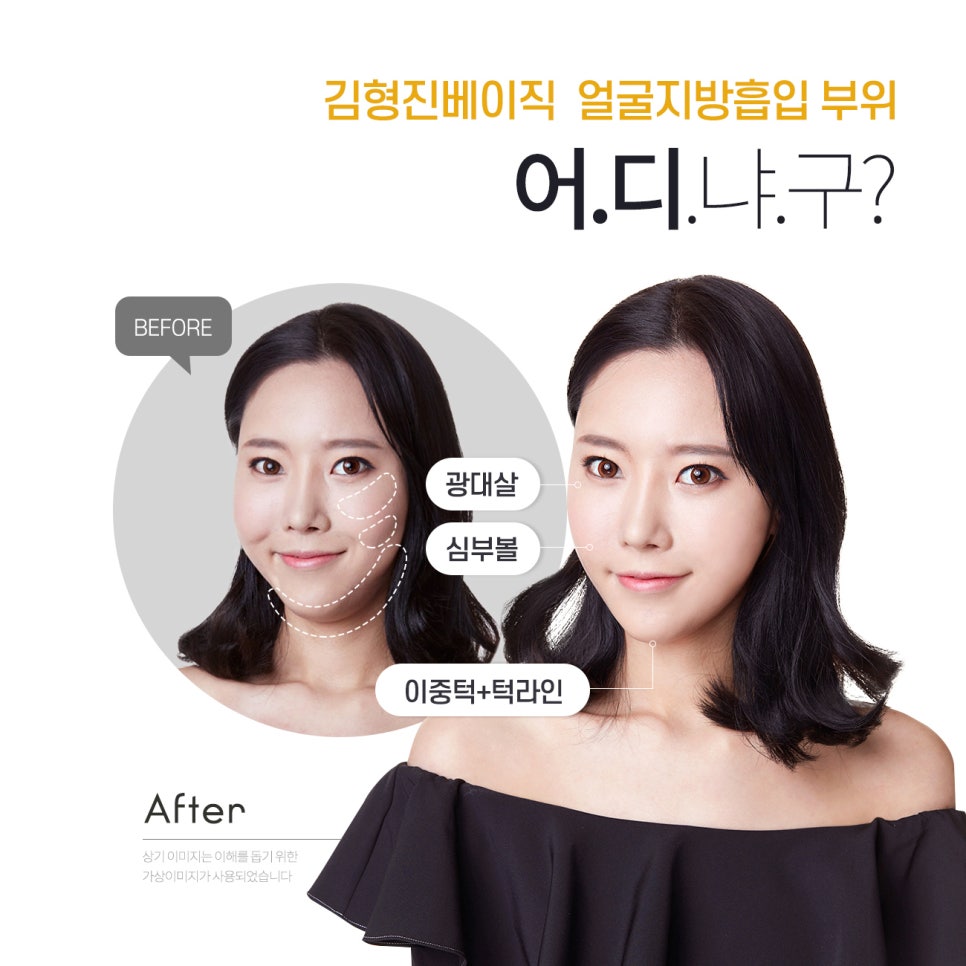 얼굴지흡후기 더이상 볼 필요 없네요 관련 이미지 3