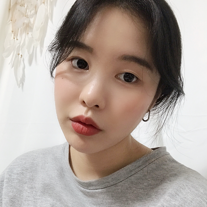 심부볼제거부작용 때문에 고민되셨다면? 관련 이미지 2