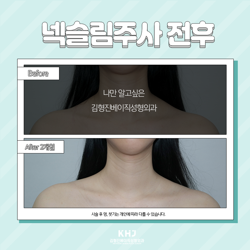 웨딩관리 뭐 해야 할지 고민된다면? 관련 이미지 5