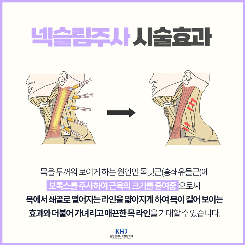 두꺼운목이 고민이라면 지금이 타이밍이에요 관련 이미지 3