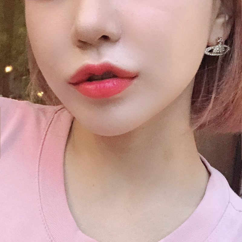 입꼬리필러시술로 자연스럽게 미소 띈 인상을 만들어요! 관련 이미지 2