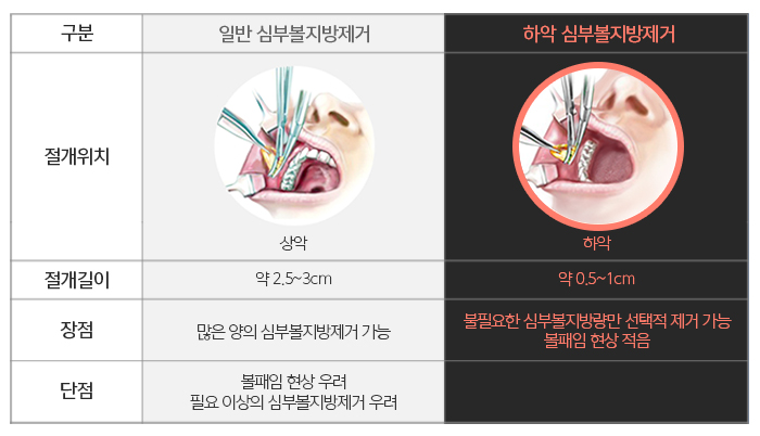 심부볼만 했어요 관련 이미지 5