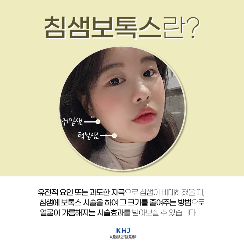 침샘보톡스주기 아직도 체크 안하면서 시술 받으신다구요!?!? 관련 이미지 3