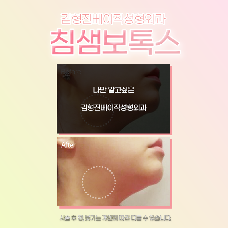 침샘치료 김형진베이직에서 가능합니다! 관련 이미지 4