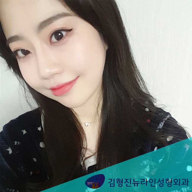 코필러시술 후기 확인하자! 관련 이미지 2