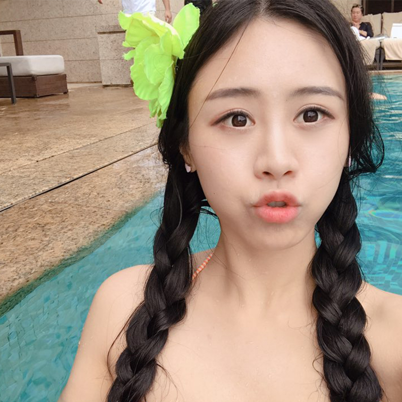 눈밑지방재배치재수술 걱정마세요 관련 이미지 1
