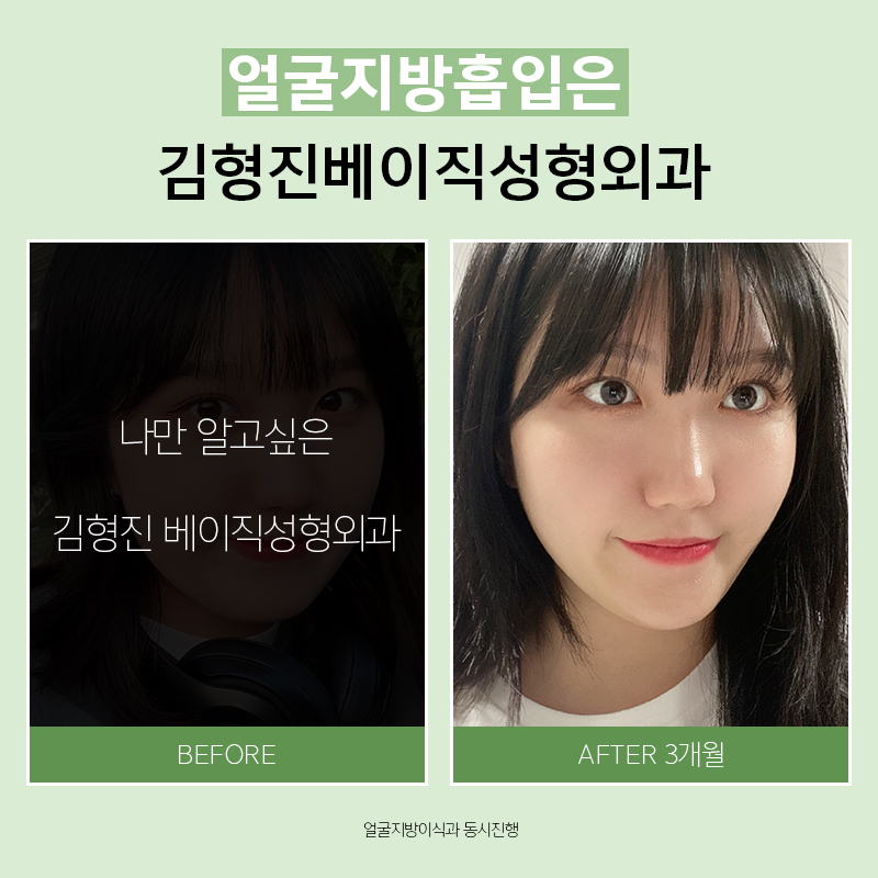 갸름한얼굴라인만드는법 쉬워요! 관련 이미지 8