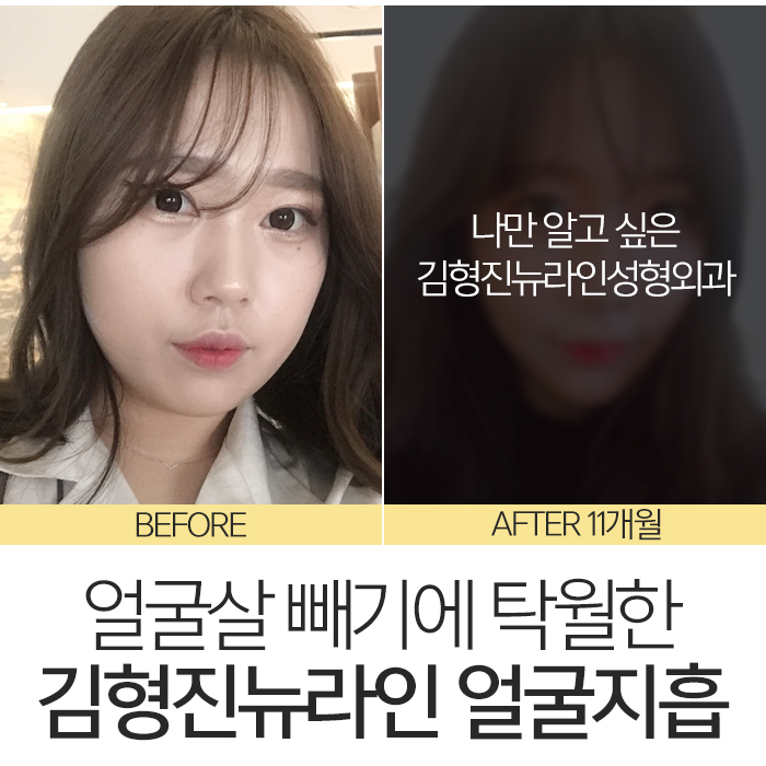 얼굴살빼는법 이렇게나 쉽다니 관련 이미지 3