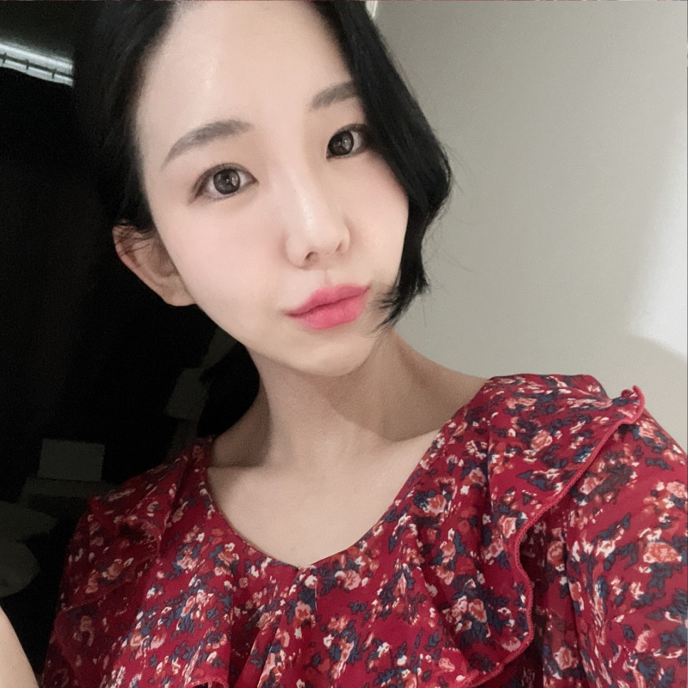 입꼬리필러 후회 돼요... 왜 이제야 했는지 관련 이미지 1