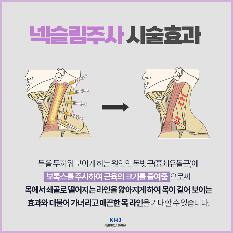 목얇아지는법 궁금하신 분들 들어오세요! 관련 이미지 3