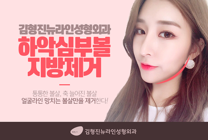 심부볼제거전후 김형진뉴라인성형외과에서 관련 이미지 3