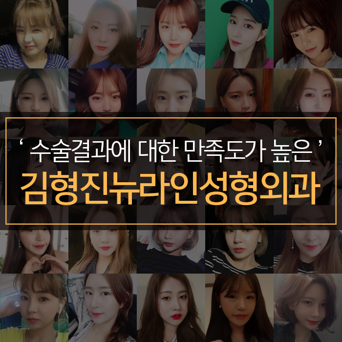 광대살지방흡입 이렇게 하는 거였어? 관련 이미지 7