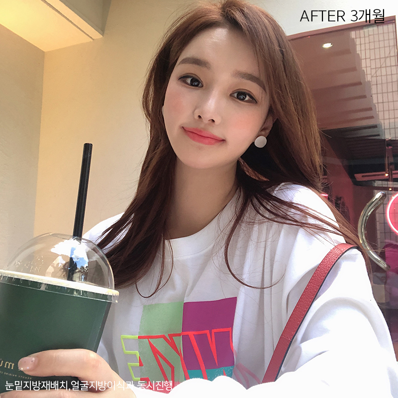 얼굴지흡방법 아직 모르신다구요? 관련 이미지 5