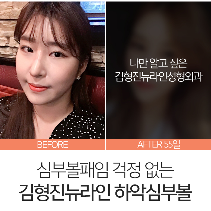 심부볼패임 어떻게 하느냐에 따라 달라요 관련 이미지 3