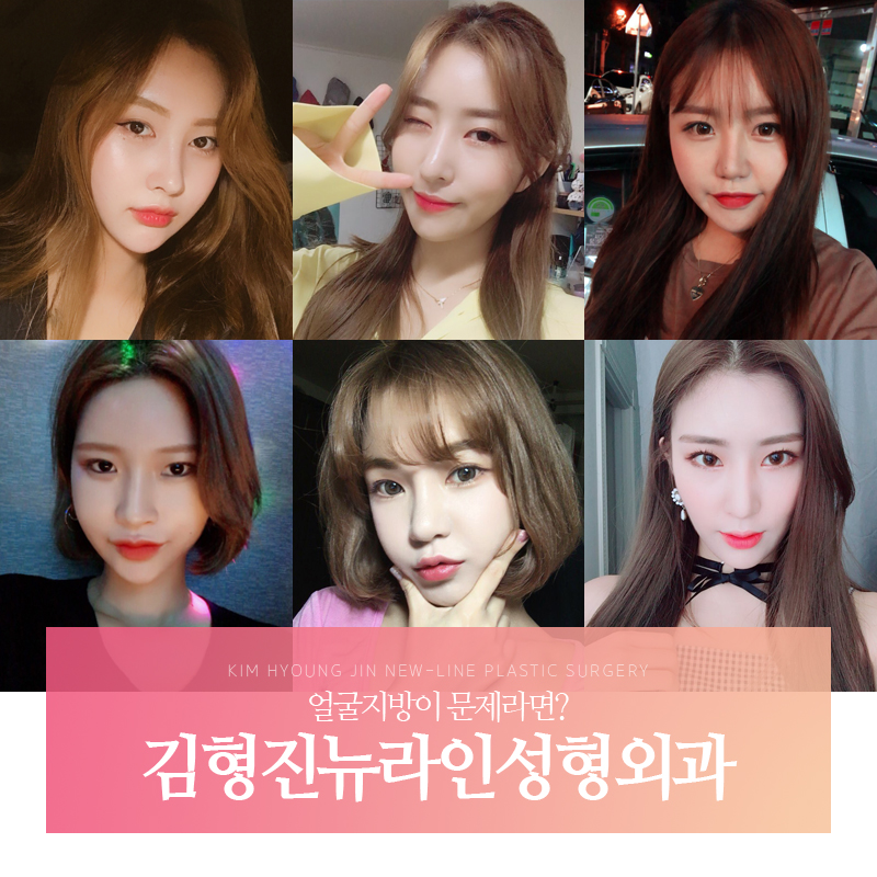 얼굴지흡 하기전에 이것부터 관련 이미지 1