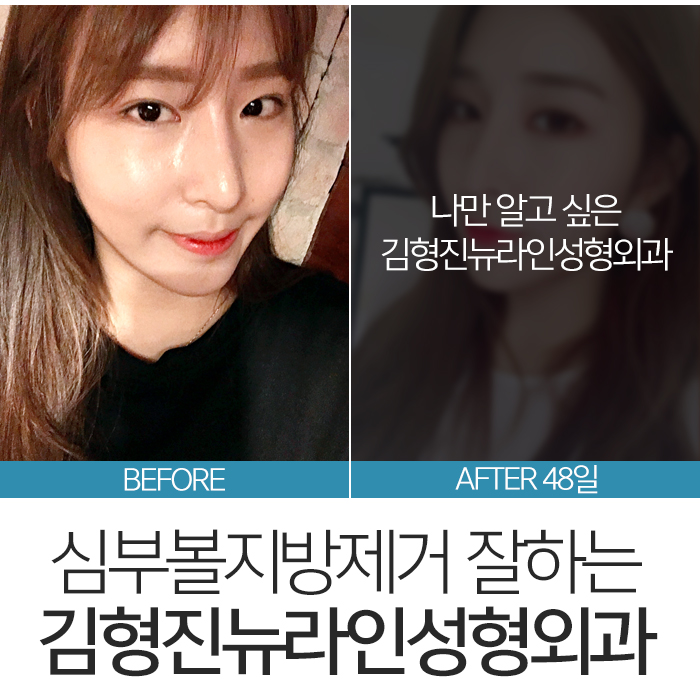 심부볼위치 정확하게 요기 관련 이미지 8