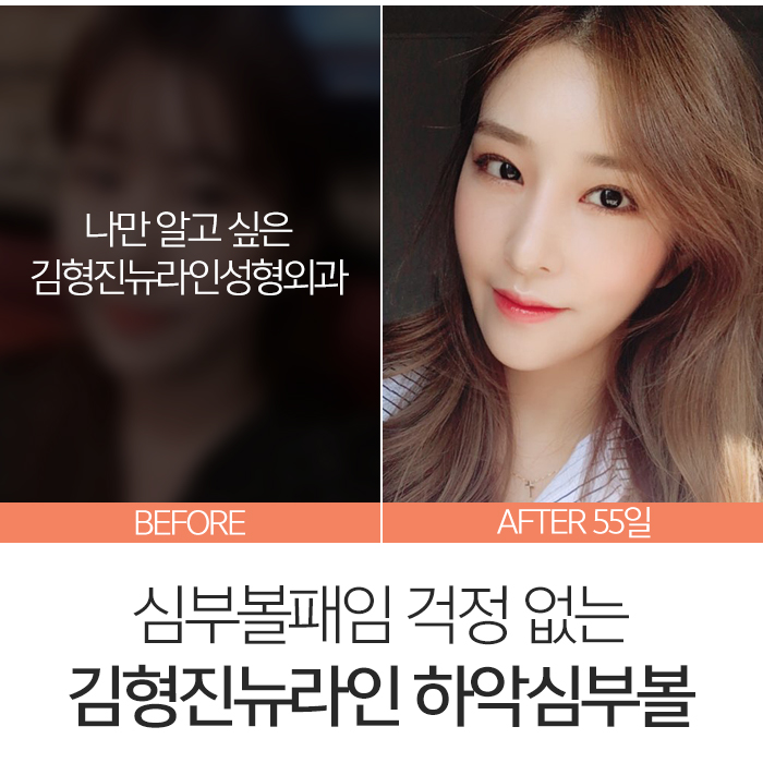 심부볼패임 어떻게 하느냐에 따라 달라요 관련 이미지 2