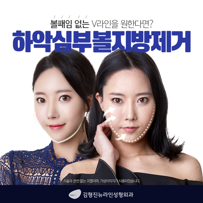 심부볼제거후기 좋을 수 밖에 없는 관련 이미지 4