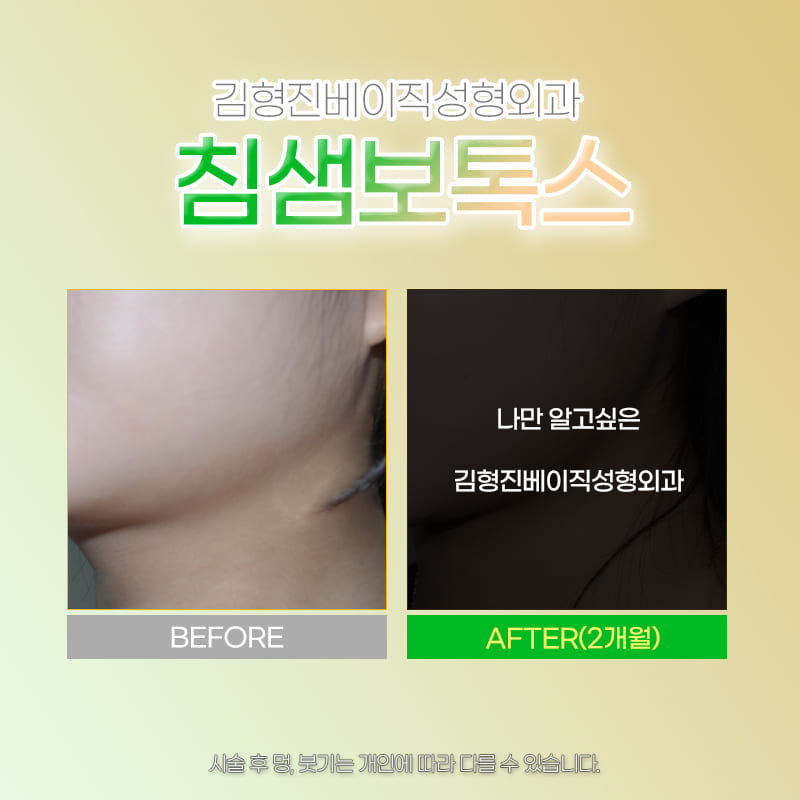 침샘치료후기 좋은 곳에서 고민 해결했어요 관련 이미지 5