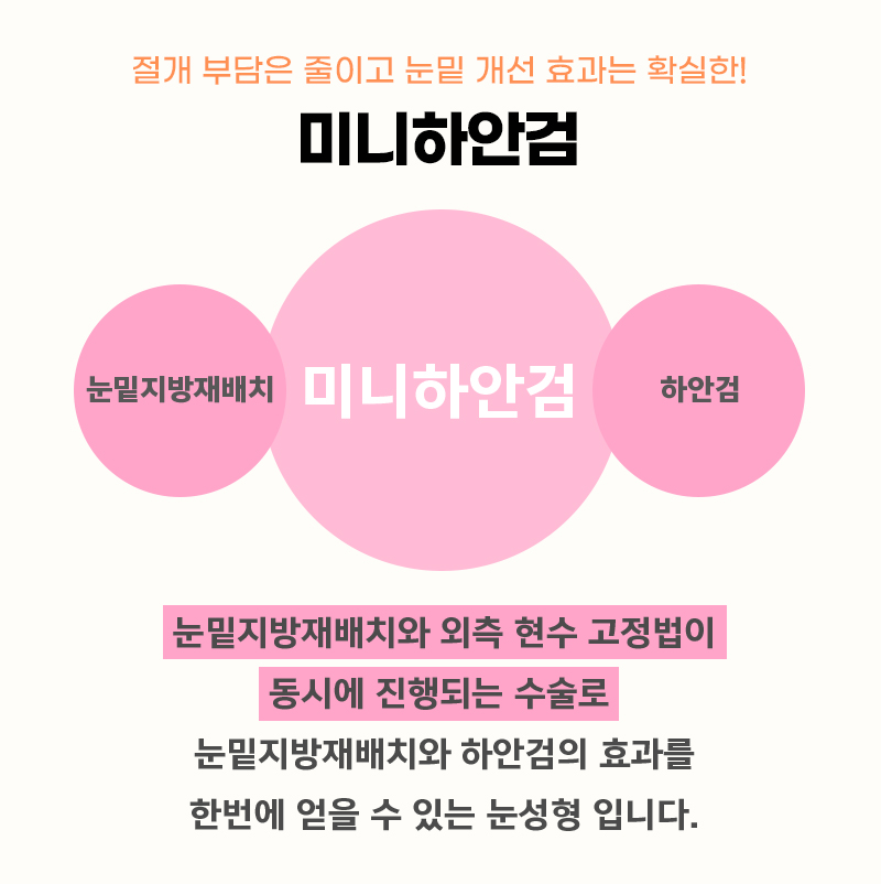효도성형추천 미니하안검 동안 얼굴 만들어 드리고 싶다면 관련 이미지 3