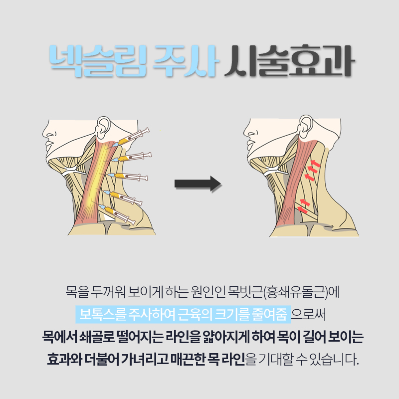 넥슬림주사로 가녀린 목 어깨 만들기 관련 이미지 4