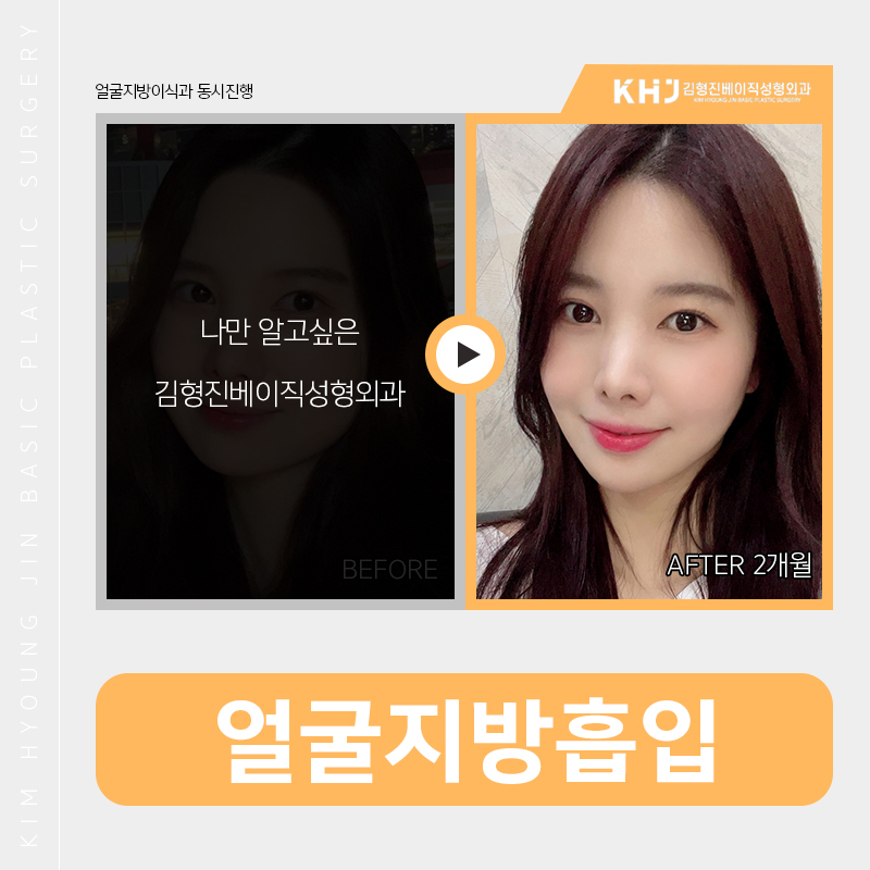 이중턱제거! 여기에요 김형진베이직! 관련 이미지 5