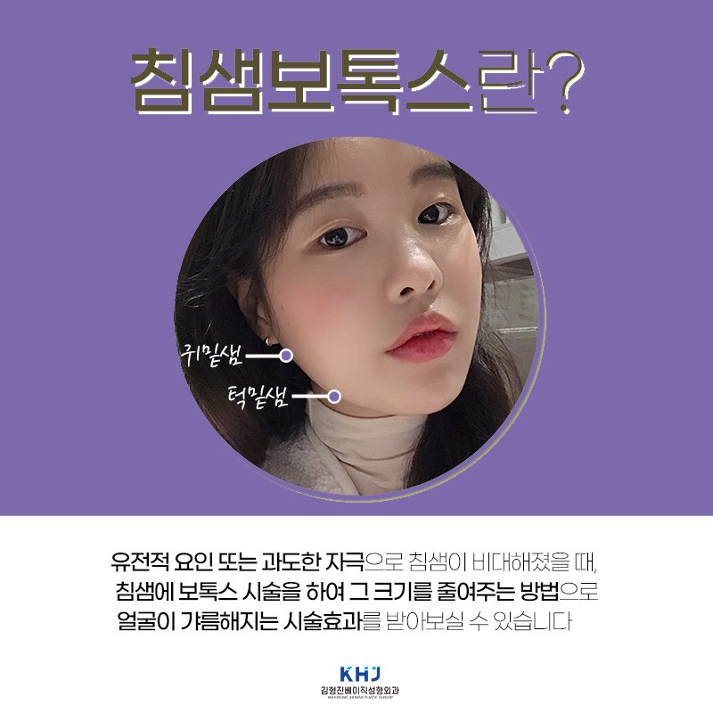 얼굴 가로길이 줄여주는 침샘보톡스시술 관련 이미지 4