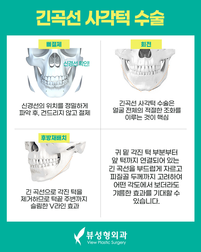 남자안면윤곽수술 개성을 살려서 관련 이미지 8