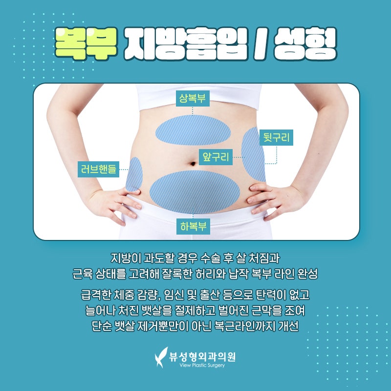 뷰성형외과가 알려주는 복부지방흡입 A to Z 관련 이미지 3