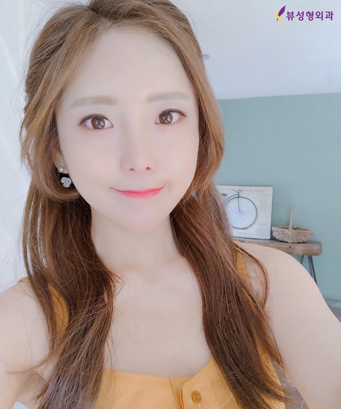 엘라스티꿈 얼굴실리프팅은 달라요! 관련 이미지 4