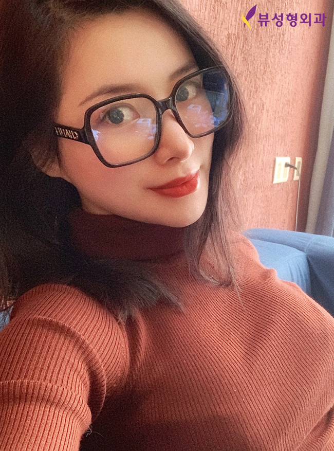 젊음의비결! 부분거상술 상안검/하안검 선택하세요 관련 이미지 7