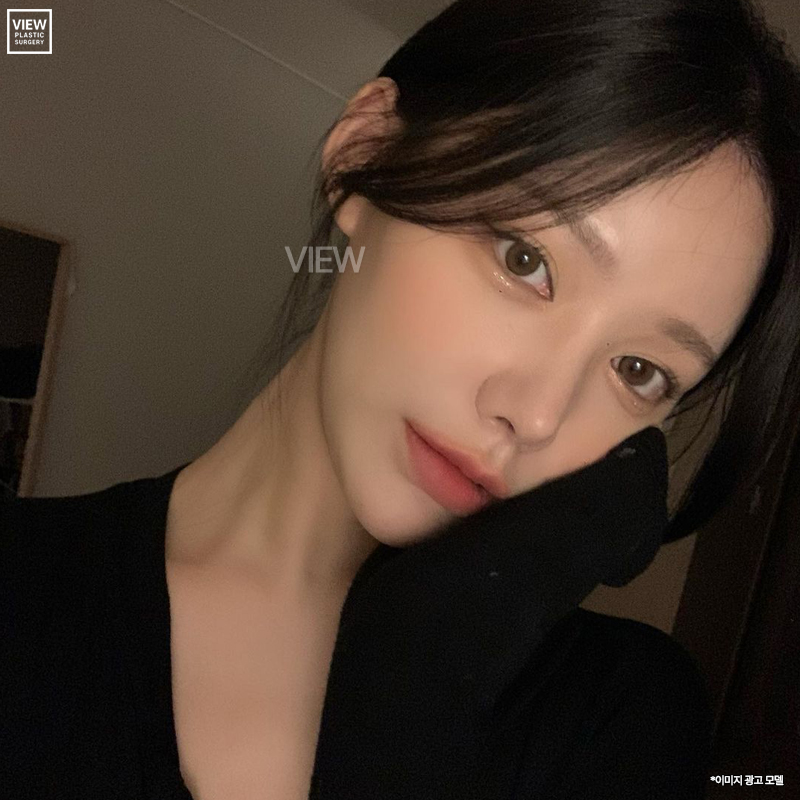 뒤트임후기 비교해서 나만의 매력적인 눈매 찾기👀💜 관련 이미지 3